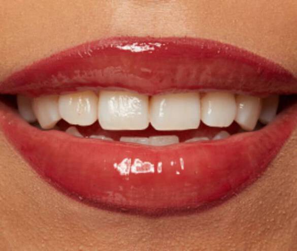 Close-up of a smiling mouth with glossy red lips and bright white teeth.